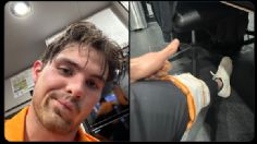 Viral: Pato en Indycar, ¿cómo fue su accidente en Toronto?